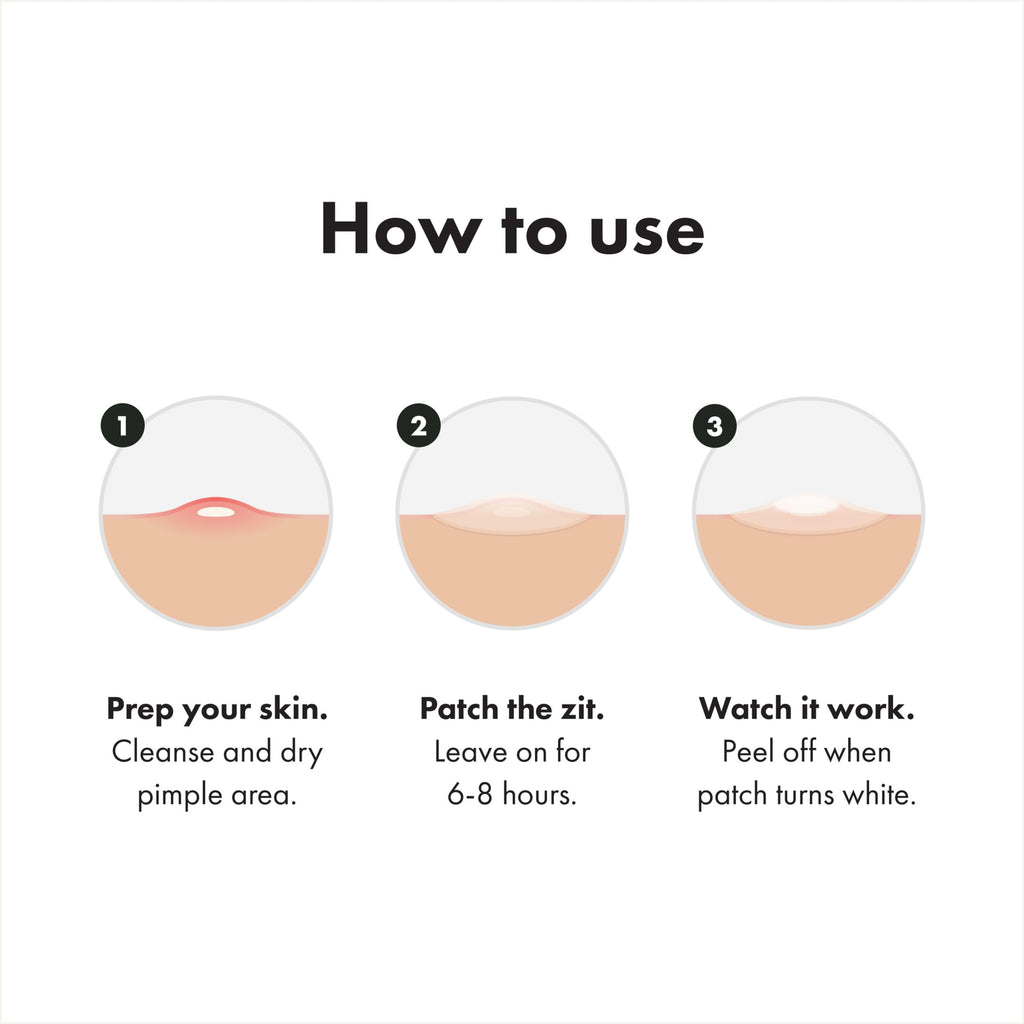 Hero Cosmetics Mighty Patch Surface Large Acne Pimple Patches, 10 Ct | Multi-Blemish Acne Spot Patch; For Cheek, Forehead, and Chin; Hydrocolloid Covers; Pimple Stickers; Vegan-friendly