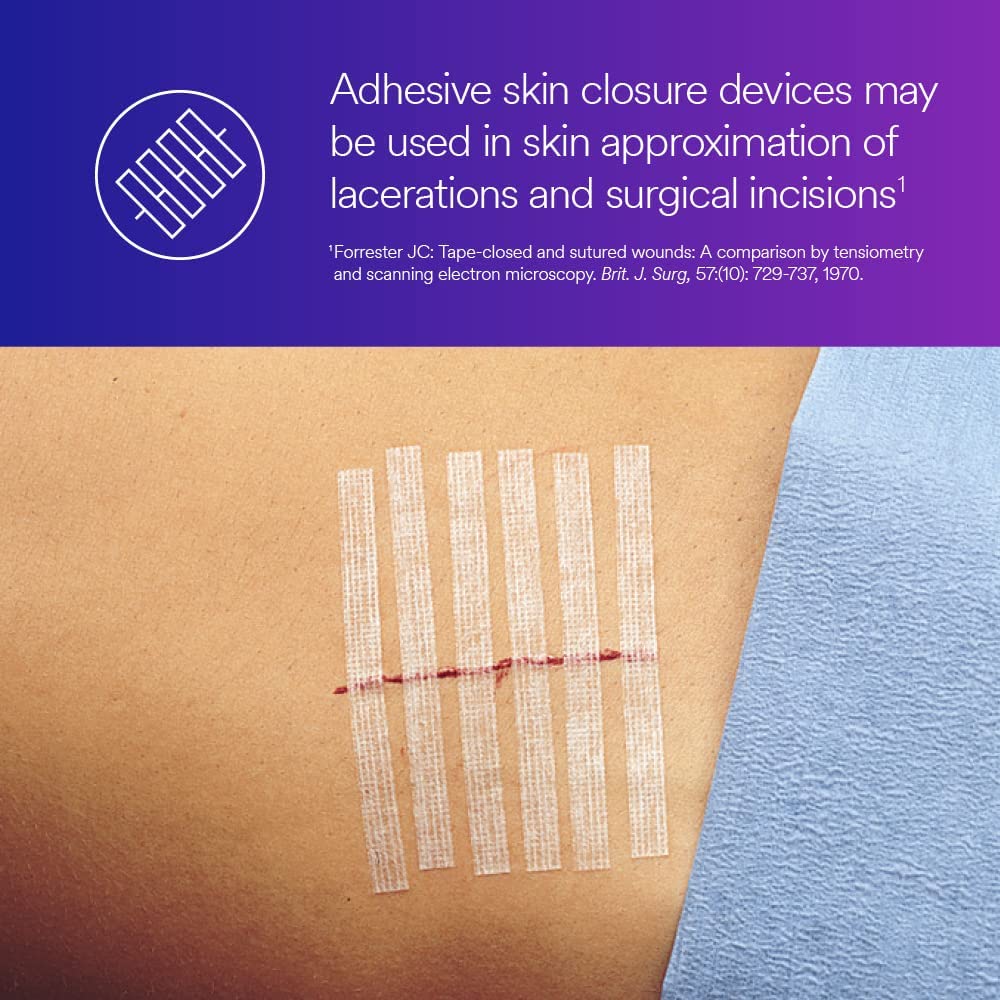 3M™ Steri-Strip™ Reinforced Adhesive Skin Closures, R1546, 1/4 in x 4 in (6 mm x 100 mm), 50 Bag/Carton, 4 Carton/Case
