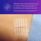 3M™ Steri-Strip™ Reinforced Adhesive Skin Closures, R1546, 1/4 in x 4 in (6 mm x 100 mm), 50 Bag/Carton, 4 Carton/Case