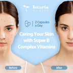 13-in-1 Vitamin B Complex Plus with Vitamin B1, B2, B3 (Niacinamide), B4, B5, B6, B7 (Biotin), B8 (Inositol), B9 (Folate), B12, C, D3, K2 - Energy, Nerve, Immune, Skin Support - 120 Vegan Capsules