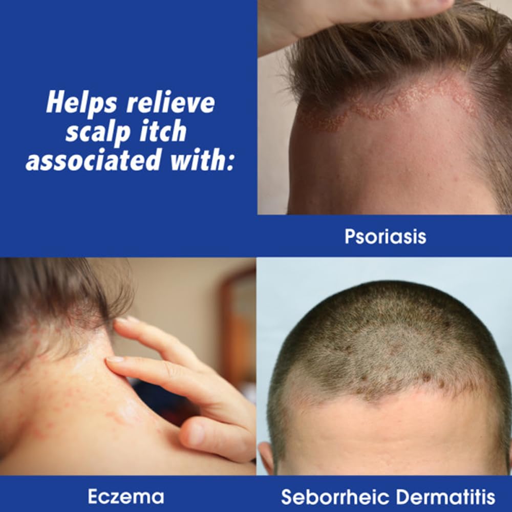 Scalpicin Maximum Strength Scalp Treatment Liquid for Itchy Scalp, Seborrheic Dermatitis & Psoriasis Scalp Treatment, Fragrance-Free, 1.5 fl oz