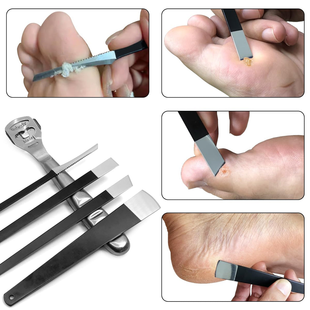 36 Pcs Callus Shaver for Feet Set, (1Stainless Foot File &1 Foot File Heads & 30 Replacement Slices Blades & 4 Pedicure Knife), Professional Callus Remover for Feet Tools for Wet and Dry Feet