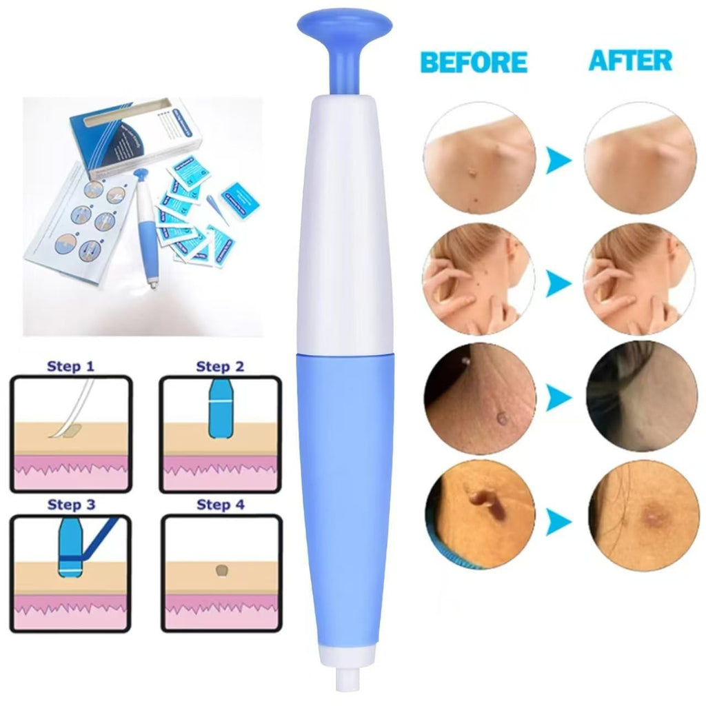 Skin Tag Remover Device Safe and Effective Skin Tag Removal Kits Home Use for Men & Women