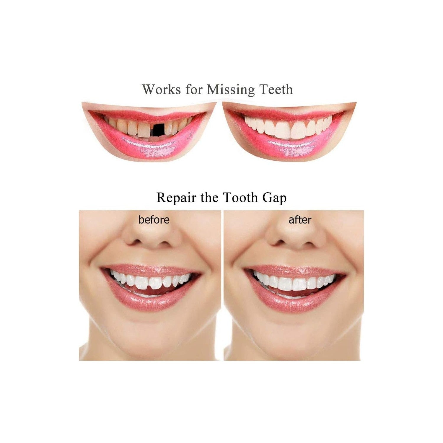 Buy now Tooth Repair Kit-Thermal Beads for Filling Fix The Missing and Broken Tooth or Adhesive The Denture Fake Teeth at indiglob india