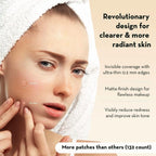 Korean Pimple Patches for Face (132 Dots) - Hydrocolloid Acne Patches & Zit Patches with Tea Tree Oil - Invisible Blemish Patches - Dermatologist Tested Korean Skin Care