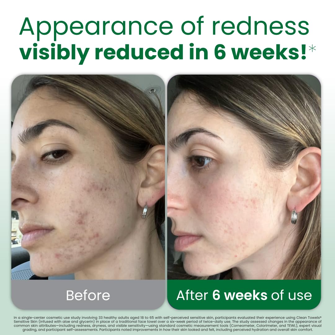 CLEAN SKIN CLUB Sensitive Skin Clean Towels® XL, Ultra-Soft Disposable Face Dry Wipes Infused with Aloe & Glycerin, XL - 1 Pack (50 count)