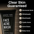 Shield Face Acne Wash for Men and Boys, Curoxyl-42 Face Wash to Clear, Treat, and Prevent Acne, Gentle formula with Niacinamide, Hyaluronic Acid, and Ceramides, Unscented, 5.1 oz, Pack of 1