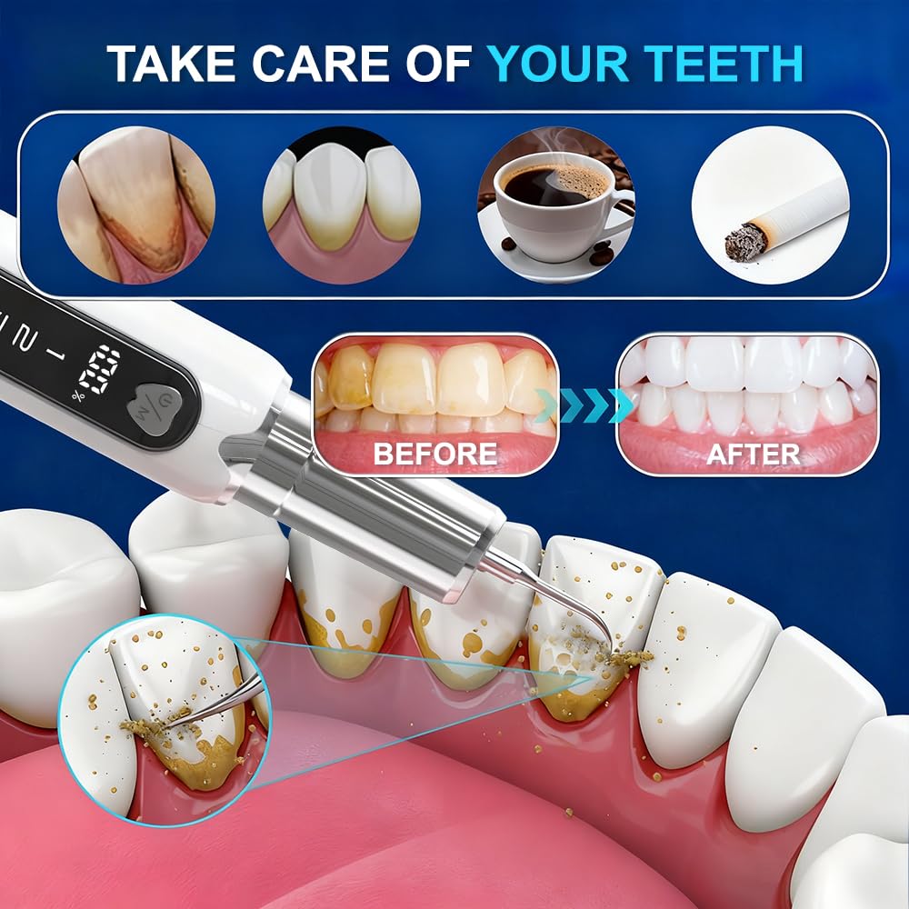 Plaque Remover for Teeth–5 Modes, LED, USB-C 4Tips Adult Teeth Cleaning Kit