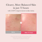 medicube TXA&Niacinamide 15% Glow Serum | Lightweight Daily Serum - For Uneven Skin Tone, Texture, and After Spot Care, High-Potency Tranexamic Acid 5%, 1.01 fl.oz