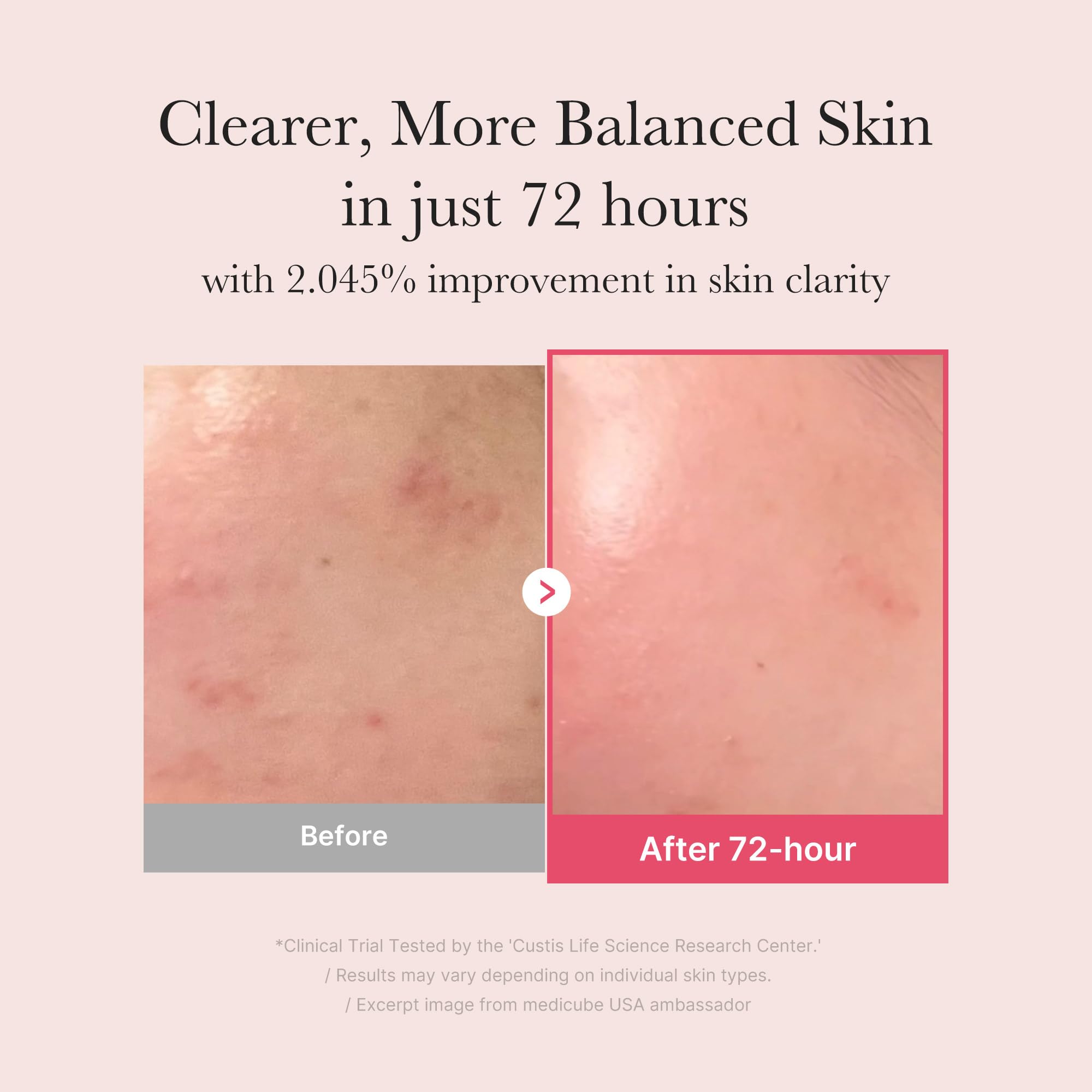 medicube TXA&Niacinamide 15% Glow Serum | Lightweight Daily Serum - For Uneven Skin Tone, Texture, and After Spot Care, High-Potency Tranexamic Acid 5%, 1.01 fl.oz