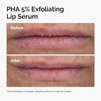 The Ordinary PHA 5% Exfoliating Lip Serum, Hydrating Overnight Lip Exfoliator Treatment, 0.5 Fl Oz