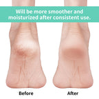 Vaincre 4 Pairs Toeless Gel Heel Socks for Women Overnight Foot Repair