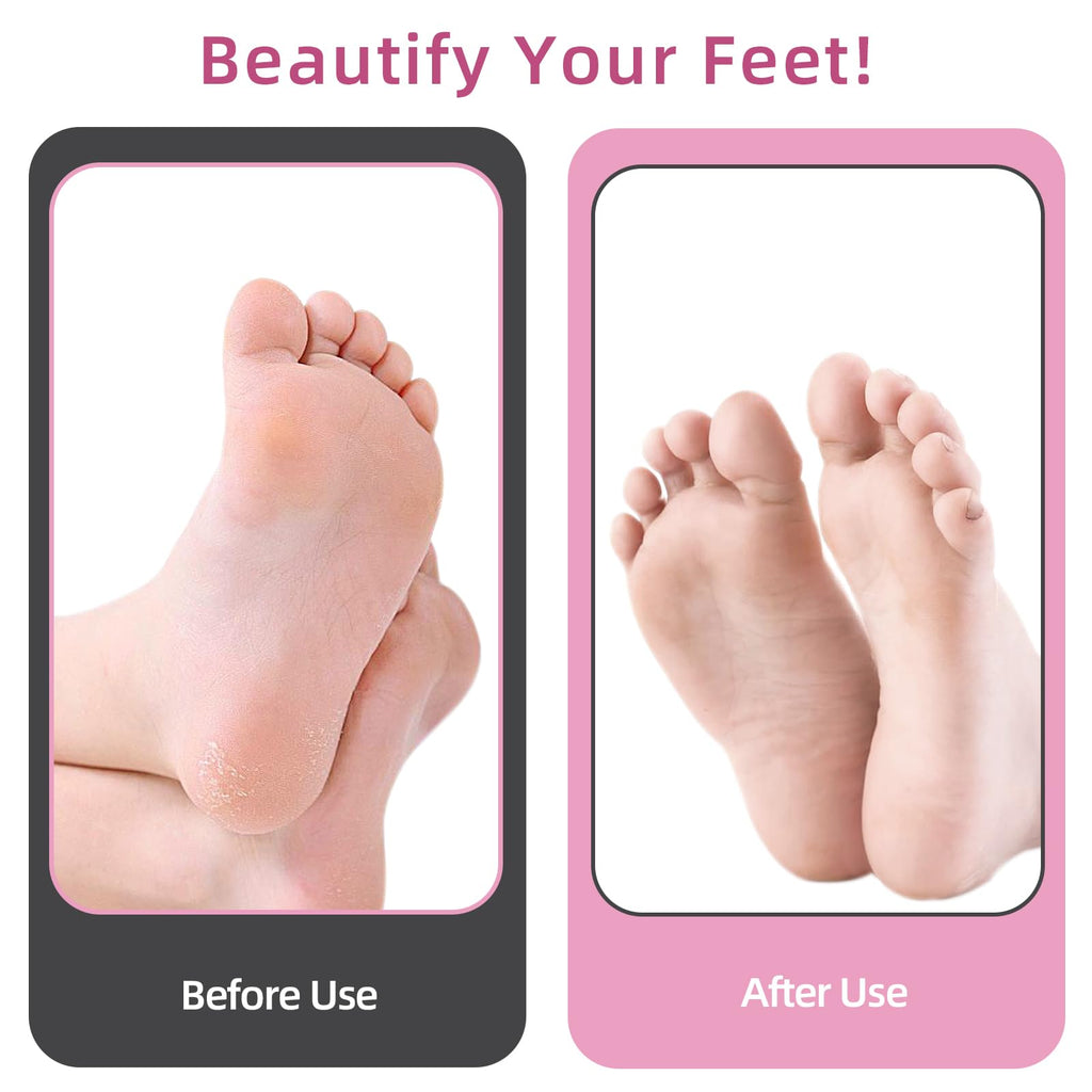 Electric Foot Callus Remover with 80pcs Sandpaper Discs, 4.8IN Longer Professional Callus Remover for Feet, Pedicure Tools Foot File for Dead Skin