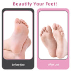 Electric Foot Callus Remover with 80pcs Sandpaper Discs, 4.8IN Longer Professional Callus Remover for Feet, Pedicure Tools Foot File for Dead Skin