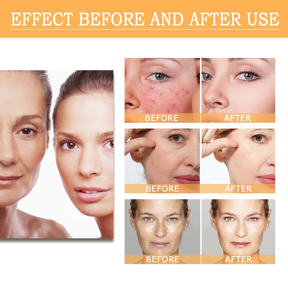 7% Glycolic Acid Exfoliating Toner, Gentle Exfoliating Toner, Smooth Skin, Restores Skin Vitality and Refreshing, Hydrating Formula, Pore Minimizer-240ml/8.44 fl.oz.