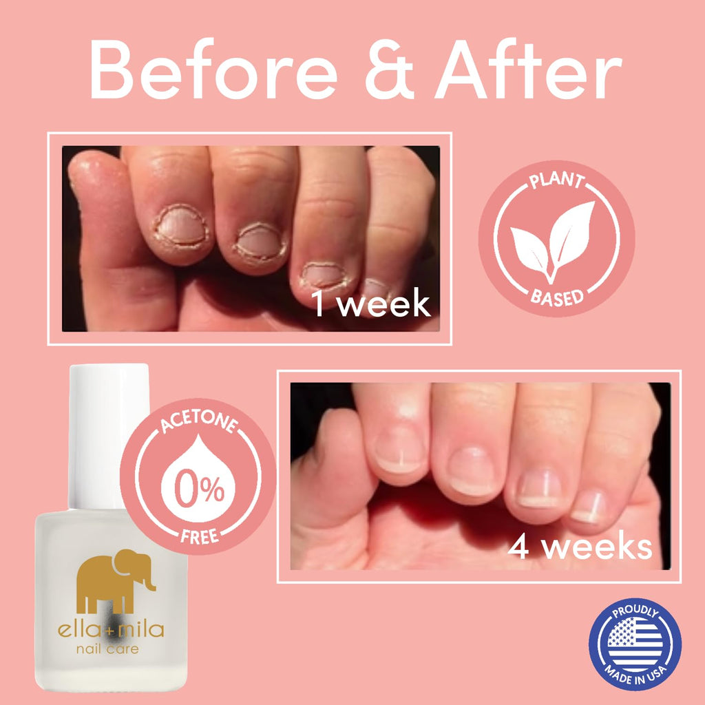 ella+mila No Bite Nail Polish - Kids Nail Biting & Thumb Sucking Prevention | Bitter-taste habit-breaker; deters nail biting & thumb sucking; clear brush-on; vegan; safe for kids & adults; 0.45 fl oz