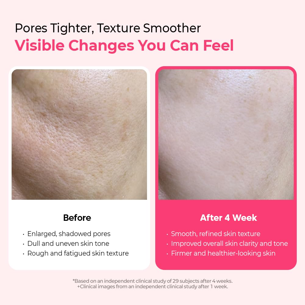 Dr.Melaxin Cyano Pink Spicule Serum with Vitamin B12, Liquid Microneedle Facial Treatment for Enlarged Pores, Niacinamide for Texture Refining & Renewal, 1.01 fl.oz