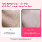 Dr.Melaxin Cyano Pink Spicule Serum with Vitamin B12, Liquid Microneedle Facial Treatment for Enlarged Pores, Niacinamide for Texture Refining & Renewal, 1.01 fl.oz