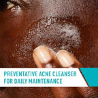 Buy now CeraVe Acne Treatment Face Wash, Salicylic Acid Cleanser with Purifying Clay, Niacinamide, and Ceramides, Pore Control and Blackhead Remover, 8 Ounce at indiglob india