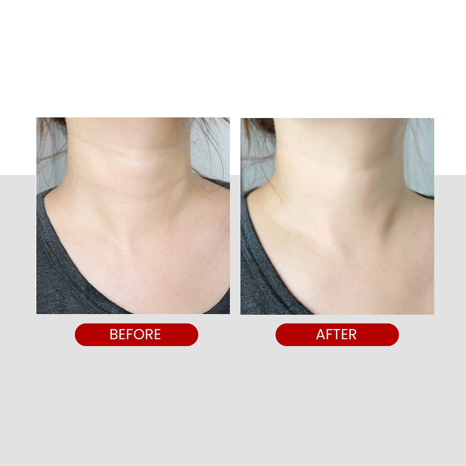 Buy now MEDI-PEEL Naite Thread Neck Cream Anti-Ageing Anti-Wrinkle Neck & DÃ©colletÃ© Cream, Neck Care, Reduces Wrinkles, Gives Skin Elasticity at indiglob india
