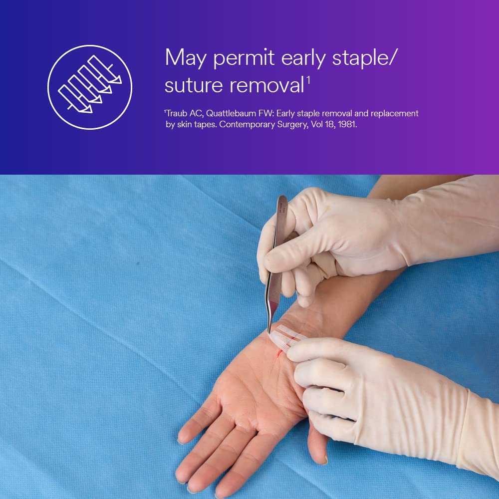 3M™ Steri-Strip™ Reinforced Adhesive Skin Closures, R1546, 1/4 in x 4 in (6 mm x 100 mm), 50 Bag/Carton, 4 Carton/Case