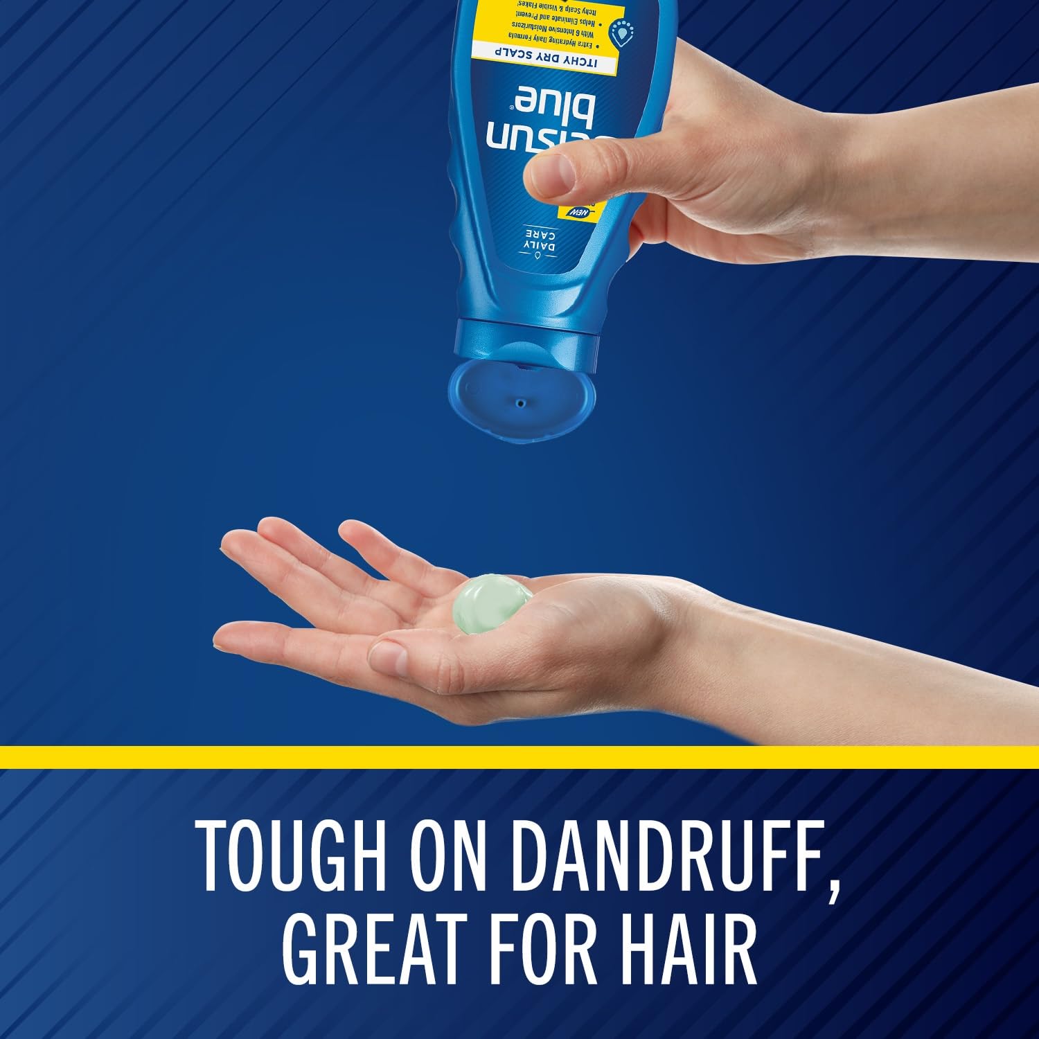 Buy now Selsun Blue Itchy Dry Scalp Anti-Dandruff Shampoo, 11 fl. oz., Extra-Hydrating Formula, Pyrithione Zinc 1% at indiglob india