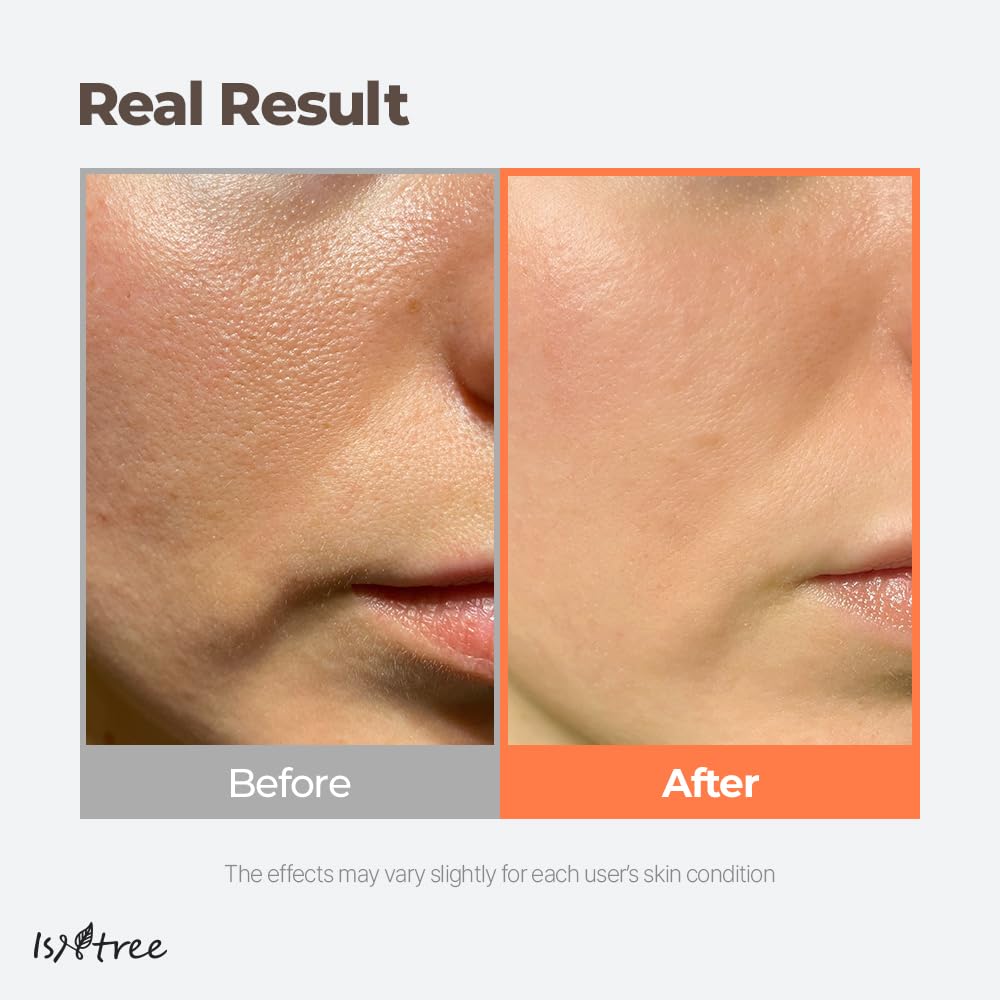 Buy now ISNTREE Green Tea Fresh Toner 200ml, 6.76 fl.oz | Korean Skincare | Toner for Oily Skin | Sebum Control | Hydrating and Refreshing at indiglob india