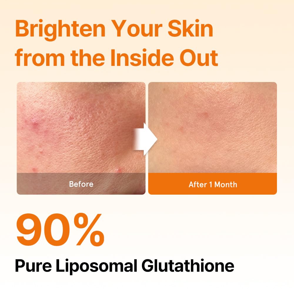 ESTHER FORMULA Liposomal Glutathione Strips (30 ct) - Glutathione Direct | Liposomal Glutathione Supplement with 90% Pure L-Glutathione for Antioxidant & Skin Glow Support, Fast-Absorbing Oral Strips