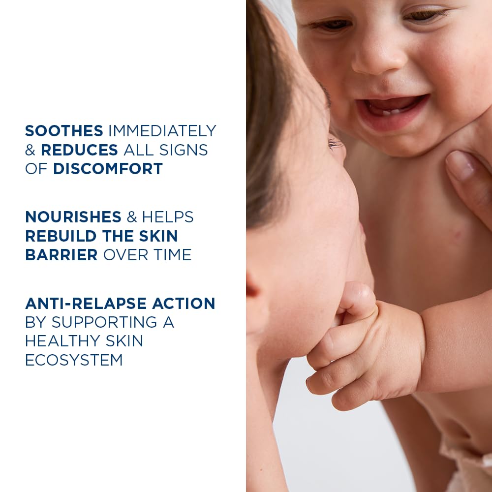 Bioderma Atoderm Intensive Balm, Hydrating Balm for Dry to Atopic Sensitive Skin, Face & Body Moisturizer with Ultra Soothing Anti-Itching Formula, Fragrance-Free, Non-Greasy & Non-Sticky for Family