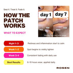 ROSEN Honey Kojic Hyper-Fade Dark Spot Patches with Tranexamic Acid, Azelaic Acid & Niacinamide for Acne Scars, Hyperpigmentation & Dark Spots | Targeted Spot Treatment | 48 Patches