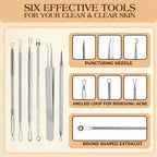 6 Pcs Pimple Popper Tool Kit Blackhead Remover, 410 Grade Stainless Steel | Professional Pimple Extractor Tool Kit for Blackheads, Comedone, Acne, Zit and Whiteheads, Stainless Steel Extraction Tools