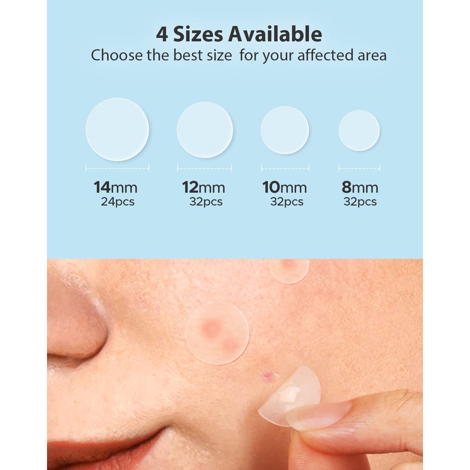 LitBear Acne Pimple Patches- Day and Night 4 Sizes 180 Dots Thin & Thick Hydrocolloid Patches with Witch Hazel, Tea Tree & Calendula Oil, Pimple Stickers for Covering Zits, Blemishes, Spots, Acne Dots