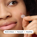 Mighty Patch Hero Cosmetics Variety Pack of Acne Pimple Patches, 26 Ct | Includes Original, Invisible+, XL Surface Patches; Hydrocolloid Patches; For Covering Zits and Blemishes; Korean Skin Care