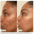Buy now Urban Skin Rx® Even Tone Cleansing Bar | 3-in-1 Multitasking Treatment Daily Cleanser, Exfoliator, & Mask | Targets Uneven Skin & Improves the Appearance of Dark Spots | Includes Applicator | 2.0 Oz at indiglob india