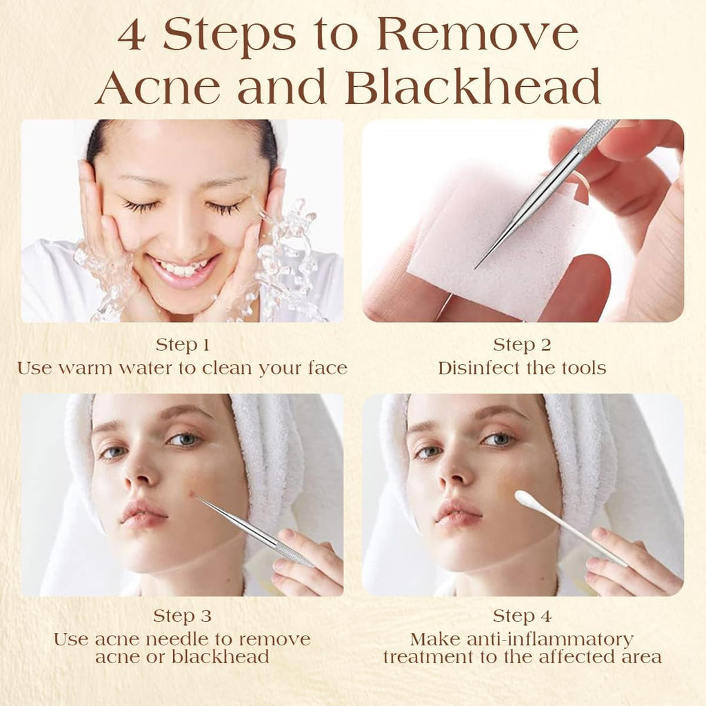 6 Pcs Pimple Popper Tool Kit Blackhead Remover, 410 Grade Stainless Steel | Professional Pimple Extractor Tool Kit for Blackheads, Comedone, Acne, Zit and Whiteheads, Stainless Steel Extraction Tools