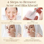 6 Pcs Pimple Popper Tool Kit Blackhead Remover, 410 Grade Stainless Steel | Professional Pimple Extractor Tool Kit for Blackheads, Comedone, Acne, Zit and Whiteheads, Stainless Steel Extraction Tools