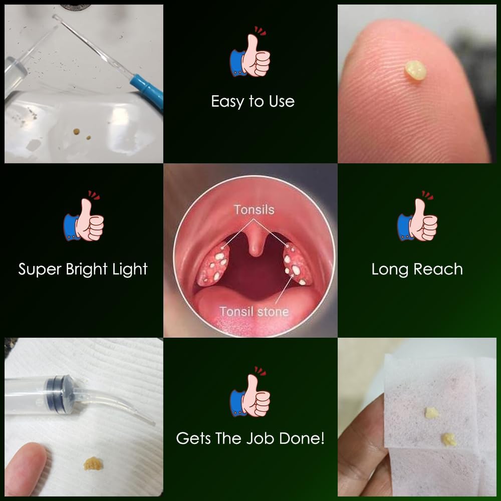 Buy now Airgoesinâ„¢ Upgraded Tonsil Stone Remover Tool, Blue, 5 Tips, Tonsillolith Pick Case + 1 Irrigator Fresh Breath Oral Rinse at indiglob india
