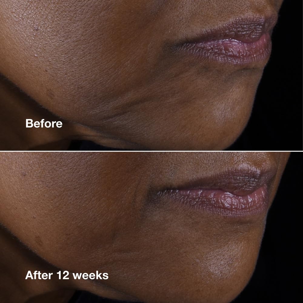 Buy now Clinique Smart Clinical Repair Anti Aging Lifting Face + Neck Cream with Peptides + Hyaluronic Acid For All Skin Types | Hydrating at indiglob india