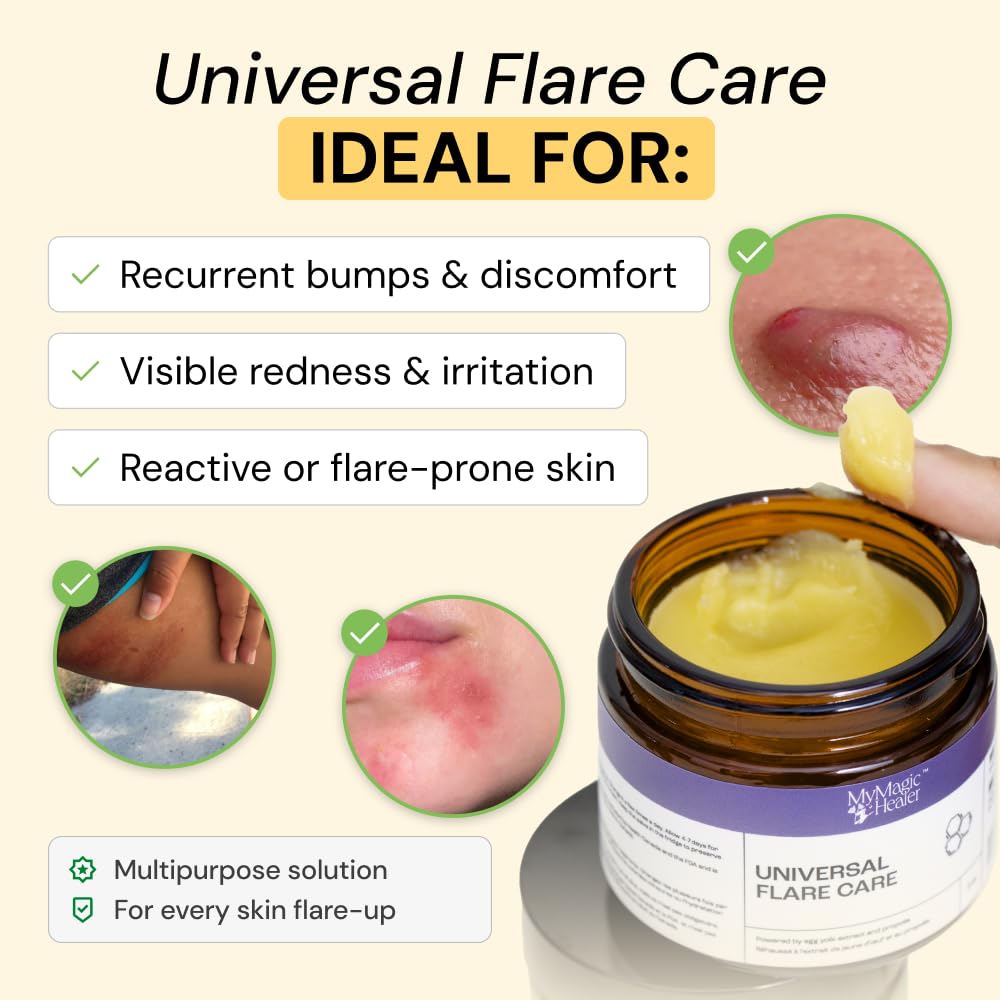 MyMagicHealer Universal Flare Care – Solution for Everyday Skin Flare-Ups | Drawing Salve for Boils & Cysts, Hidradenitis Suppurativa, Folliculitis | Irritated Skin and Chafing Relief 1 oz