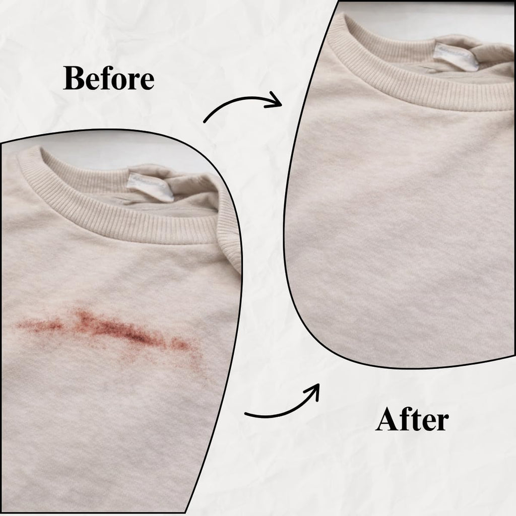 Blood Stain Remover for Clothes (10.14oz)