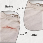 Blood Stain Remover for Clothes (10.14oz)