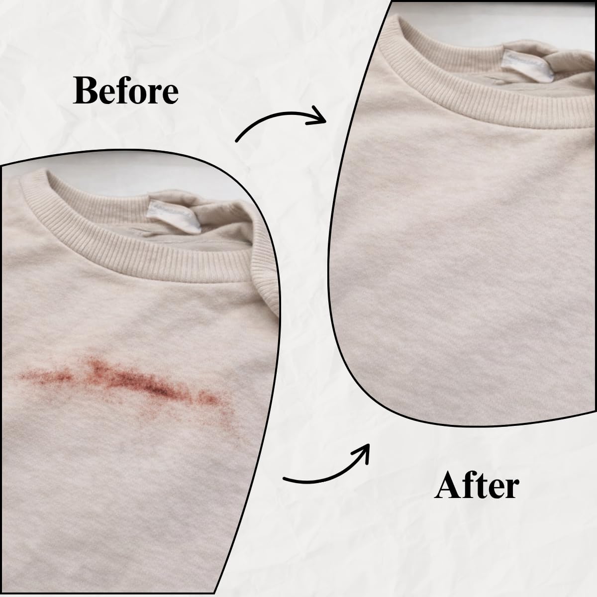 Blood Stain Remover for Clothes (10.14oz)