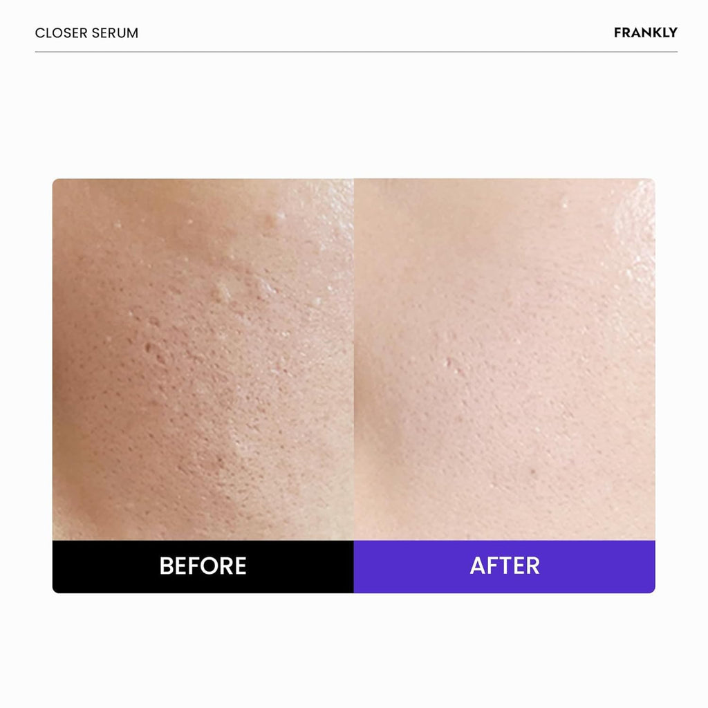 FRANKLY Closer Serum Mega Jumbo | Pore Minimizer Serum | 3.38 fl oz | 9 Peptides, Vegan Collagen, Adenosine, PHA | Korean Pore Minimizer for Glass Skin, Anti-Aging, Hydration, Elasticity