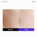 FRANKLY Closer Serum Mega Jumbo | Pore Minimizer Serum | 3.38 fl oz | 9 Peptides, Vegan Collagen, Adenosine, PHA | Korean Pore Minimizer for Glass Skin, Anti-Aging, Hydration, Elasticity
