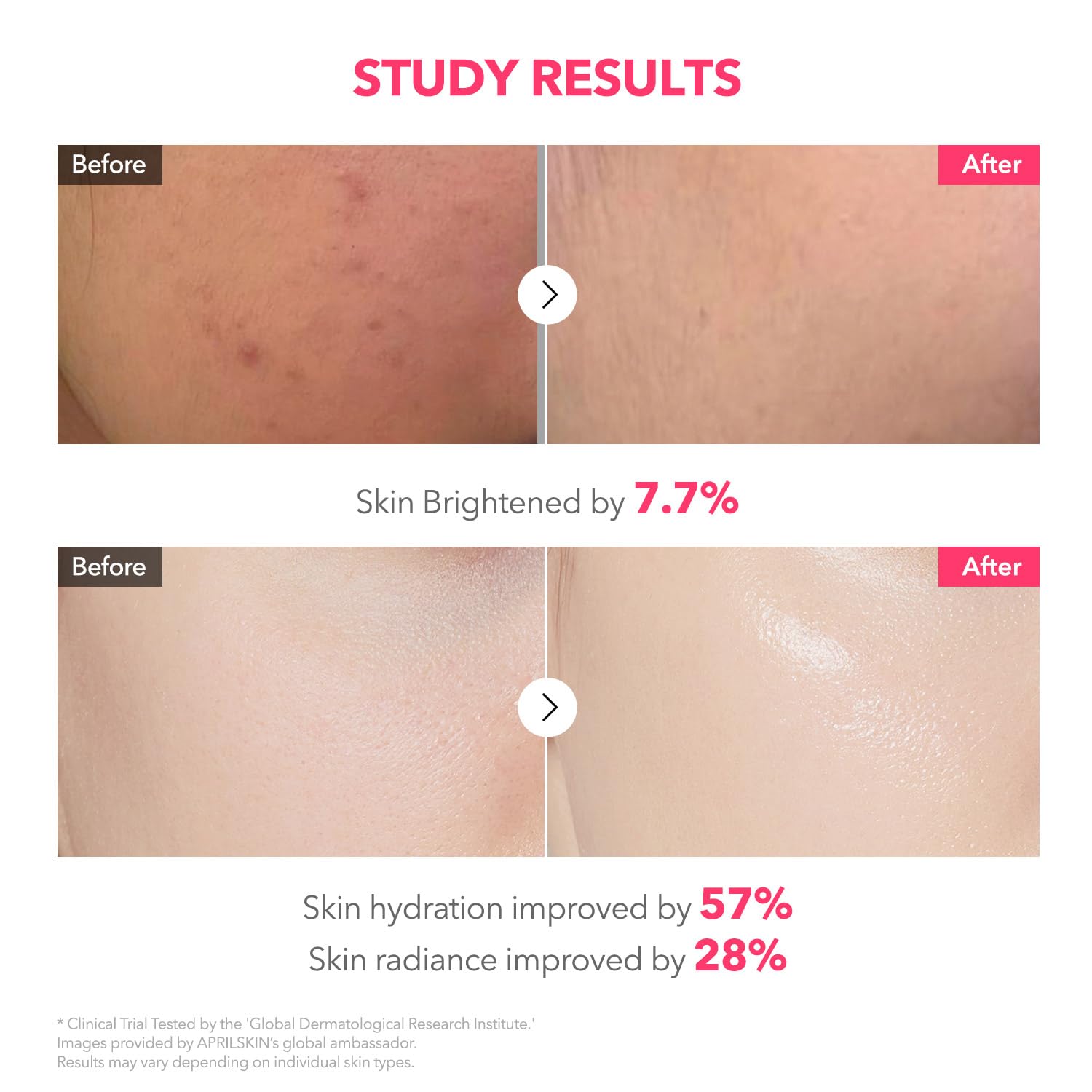 APRILSKIN TXA Pink Capsule Gel Mask 4EA | Overnight Gel Mask with Tranexamic Acid - Hydrating & Firming, Uneven Skin Tone, 30g 4ea