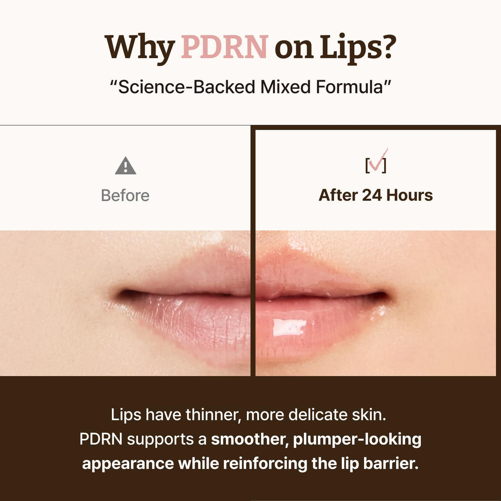 Dr.Reju-All Advanced PDRN Rejuvenating Lip Serum 0.3 Fl Oz | Hydrating Lip Balm, Lipozip PDRN for Glowy, Dewy Lips, Gentle Exfoliating Lip Moisturizer, With Hibiscus & Lactic Acid