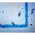 Buy now McMaster Method Microscope Slide - FEC (Fecal Egg Count) or Worm Count, Double Chamber Slide for Parasite Testing and Management in Horses, Sheep, Goats and Cattle at indiglob india