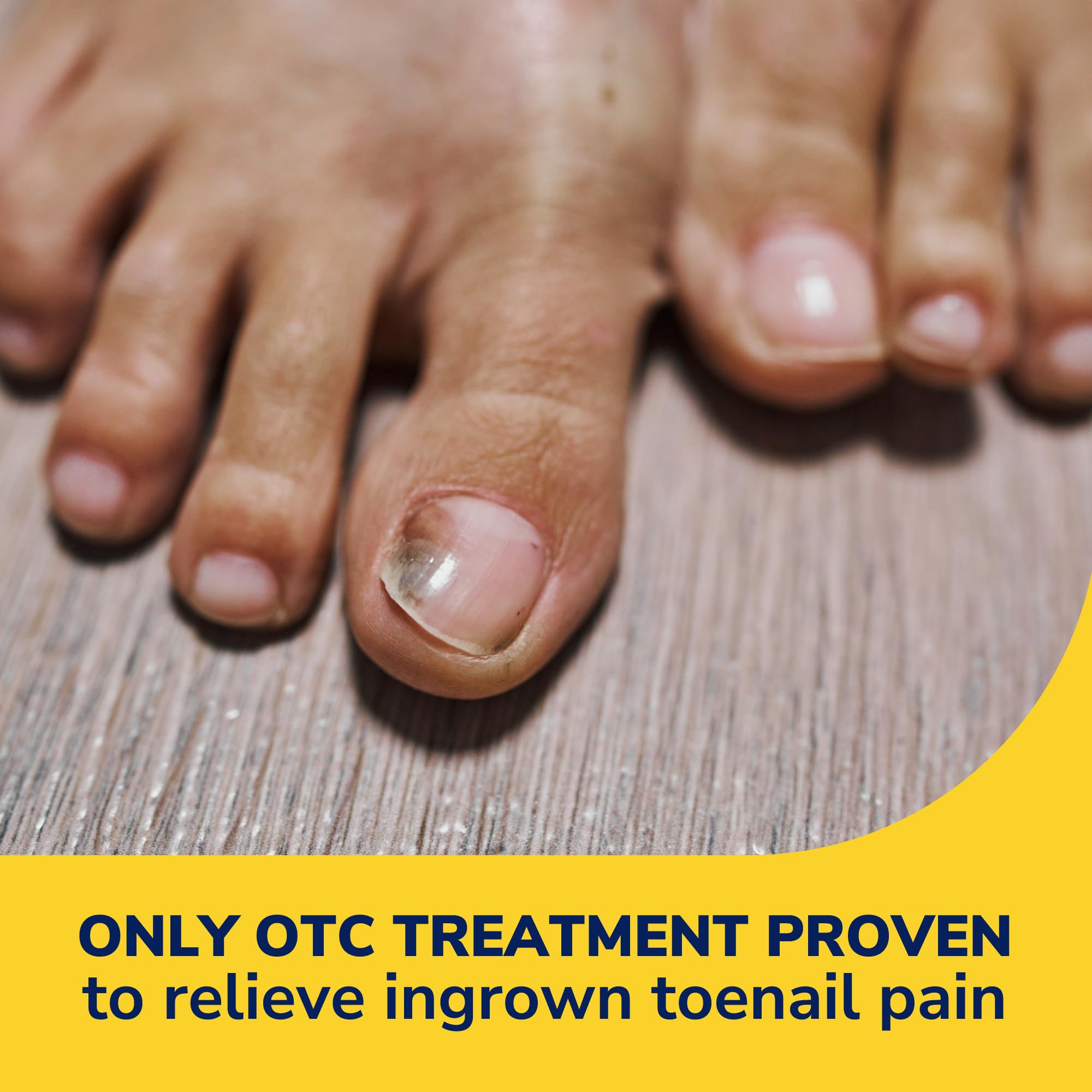 Dr. Scholl's INGROWN TOENAIL PAIN RELIEVER & TRIMMING KIT, 0.3 oz // Only OTC Treatment Proven to Relieve Ingrown Toenail Pain - Includes Medicated Gel + Foam Rings + Bandages + Clipper & Pusher Tools