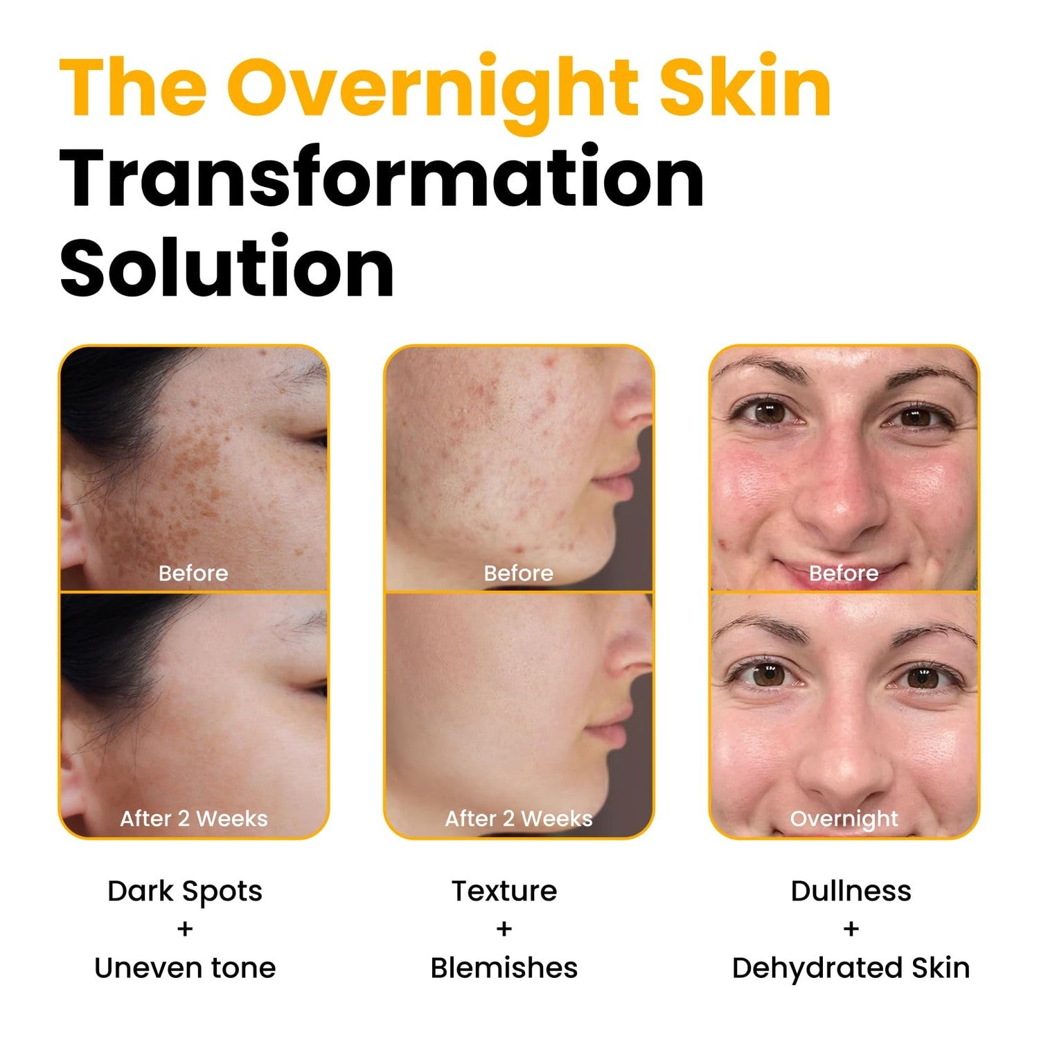 QUIA Turmeric + Kojic Acid Overnight Wrapping Mask – Hydration Mask for Glowing Skin – Evens Tone, Soothes Redness and Improves Skin Texture – Korean Skincare 75ML