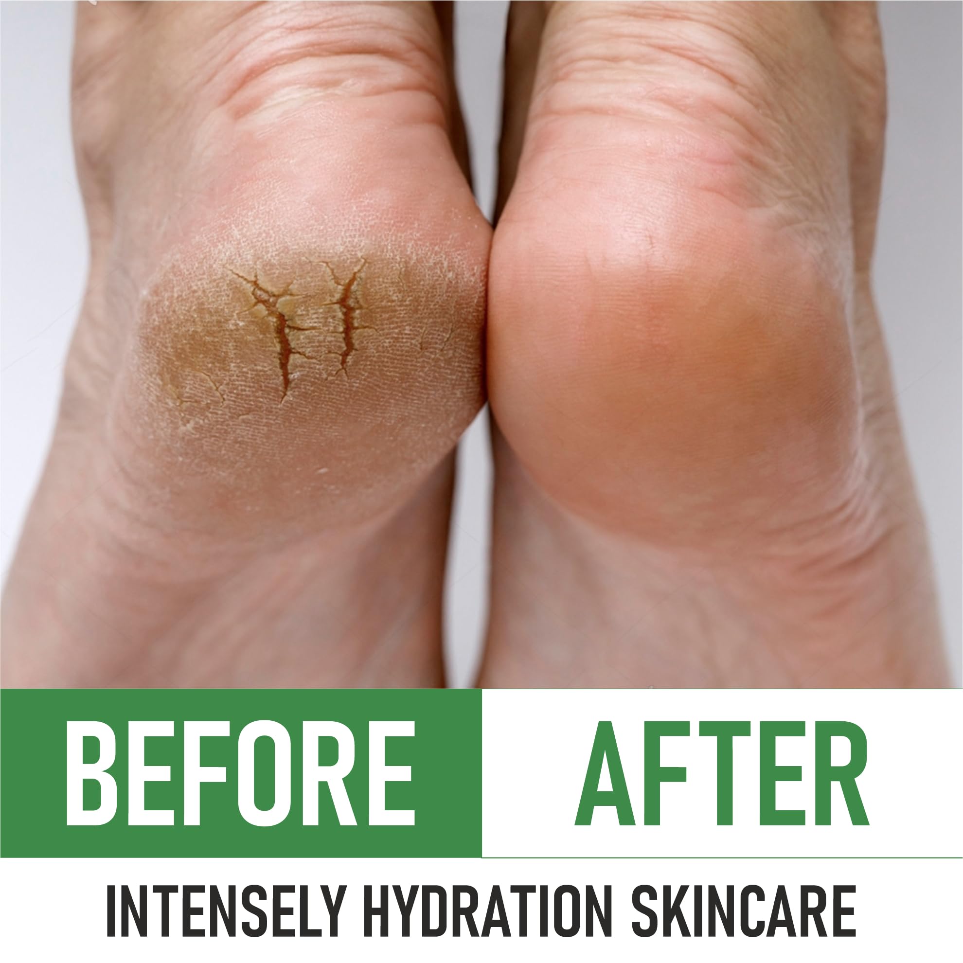PurOrganica Urea 40% Foot Cream - Made in USA - Corn, Callus and Dead Skin Remover - Moisturizer & Rehydrater - For Thick, Cracked, Rough, Dead & Dry Skin - For Feet, Elbows and Hands - Pack of 2